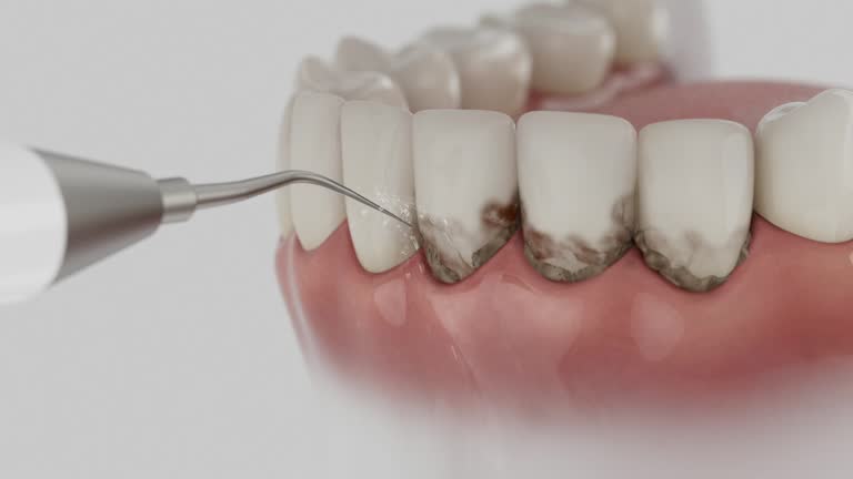 Reliable Invisalign Clear Aligners contractor in Leake County County, MS by Dentist Open Now
